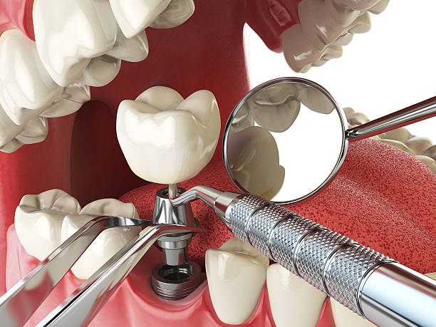 Best Emergency TMJ Treatment in Kinsley, KS