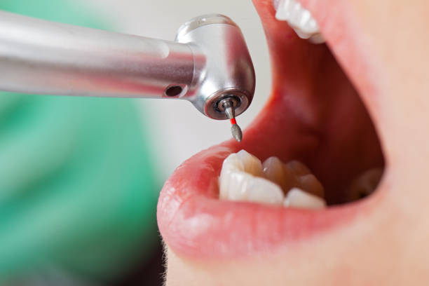 Best Emergency Denture Repair in Kinsley, KS